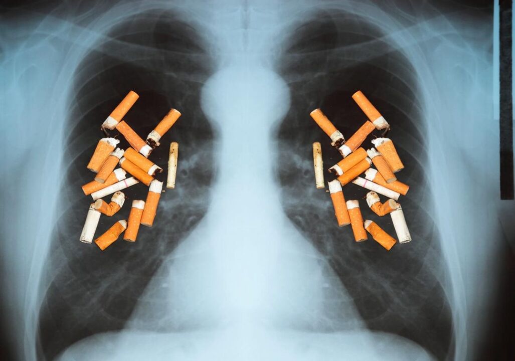 Cómo los cigarrillos afectan los pulmones