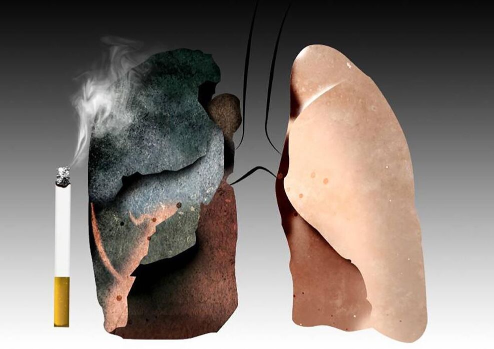 Cómo afecta fumar al cuerpo.
